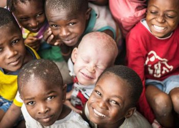 Recognize, celebrate and ‘stand in solidarity’ with persons with albinism