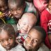 Recognize, celebrate and ‘stand in solidarity’ with persons with albinism