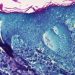Monkeypox becoming established in non-endemic countries warns Tedros; calls for more testing, vaccines to end COVID pandemic |