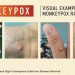 Emergency Committee meets again as Monkeypox cases pass 14,000: WHO |