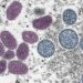 Monkeypox declared a global health emergency by the World Health Organization |