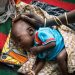 Horn of Africa: Over 7 million children under the age of 5 remain malnourished